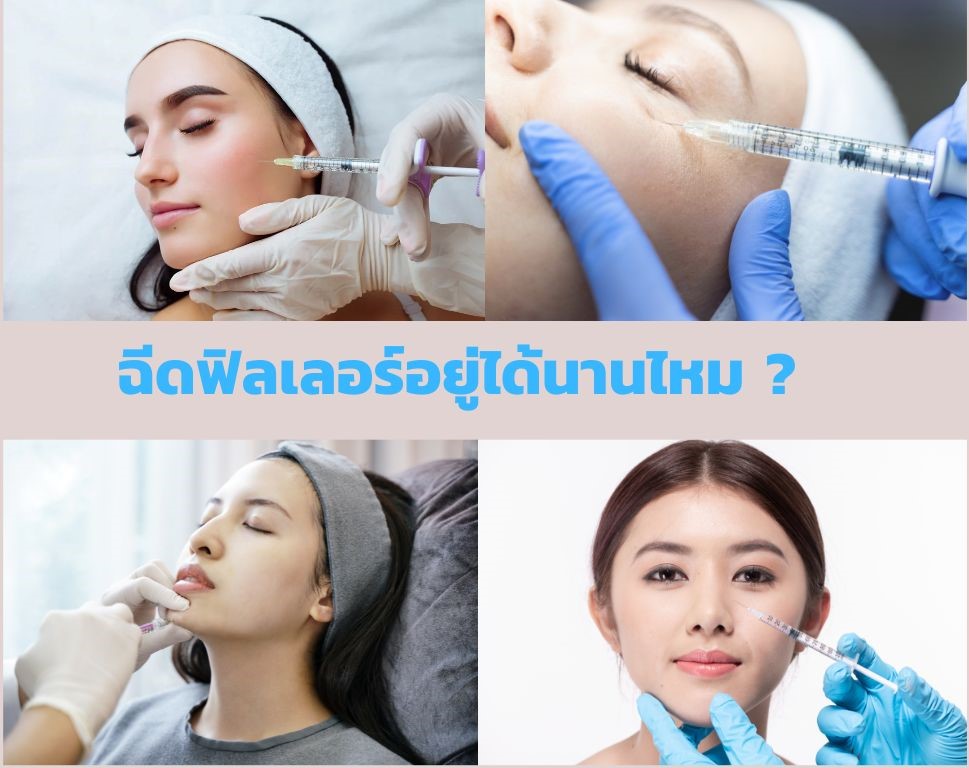 ฉีดฟิลเลอร์อยู่ได้นานไหม ขึ้นอยู่กับอะไร ดูแลอย่างไรไม่ให้ฟิลเลอร์สลายเร็ว